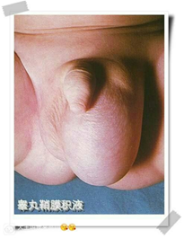 22222